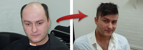 Picture shows Chris Thomas before and after NSHR